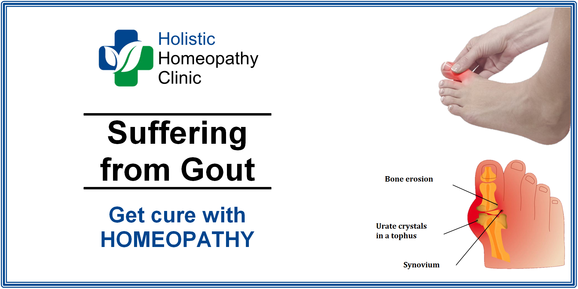 Osteo, Rheumatoid, Psoriatic & Gouty Arthritis - Holistic Homeopathy